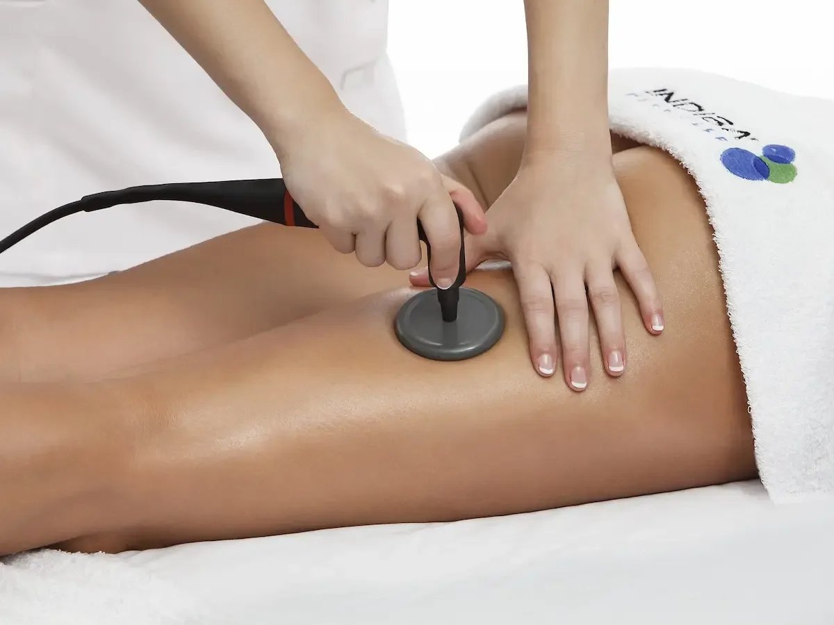 Tratamiento de INDIBA en piernas – Centro de Estética Merche