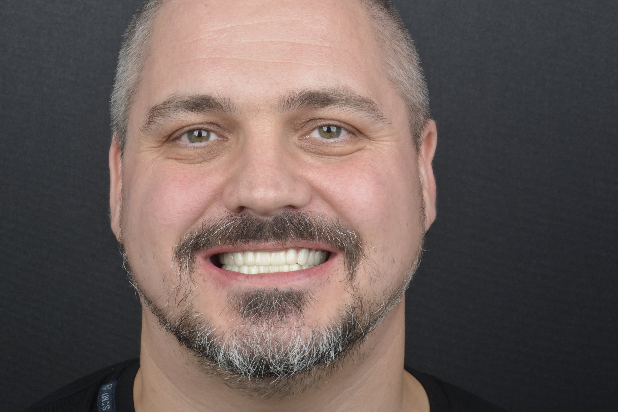 Lukáš Bouda, výsledek ošetření