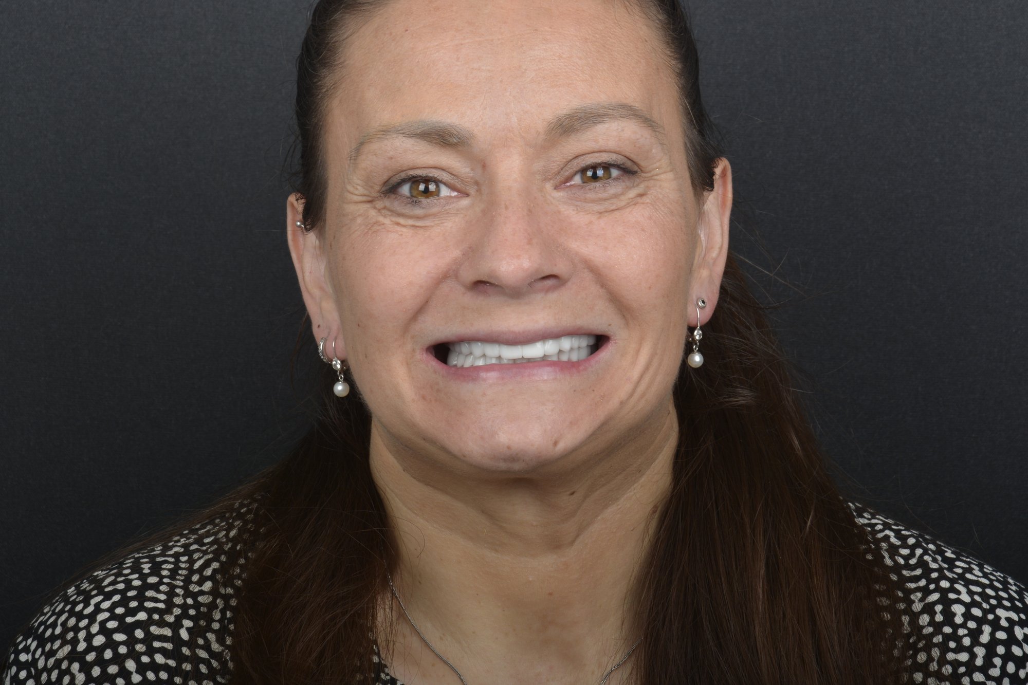 Jana Maláková, výsledek ošetření