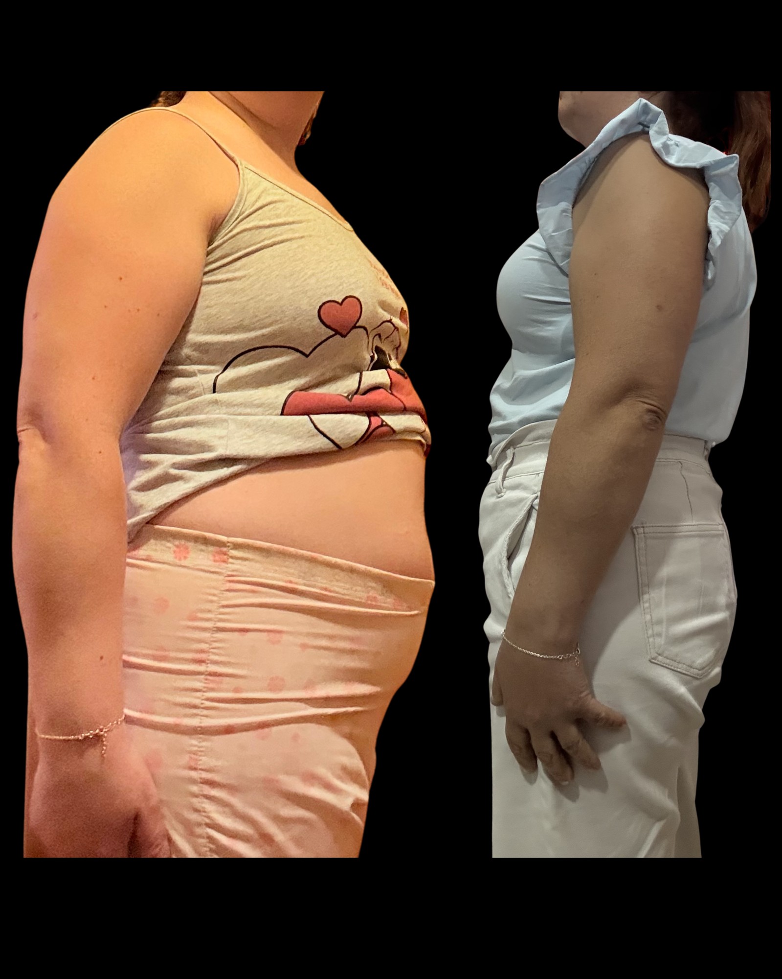 Transformação antes e depois