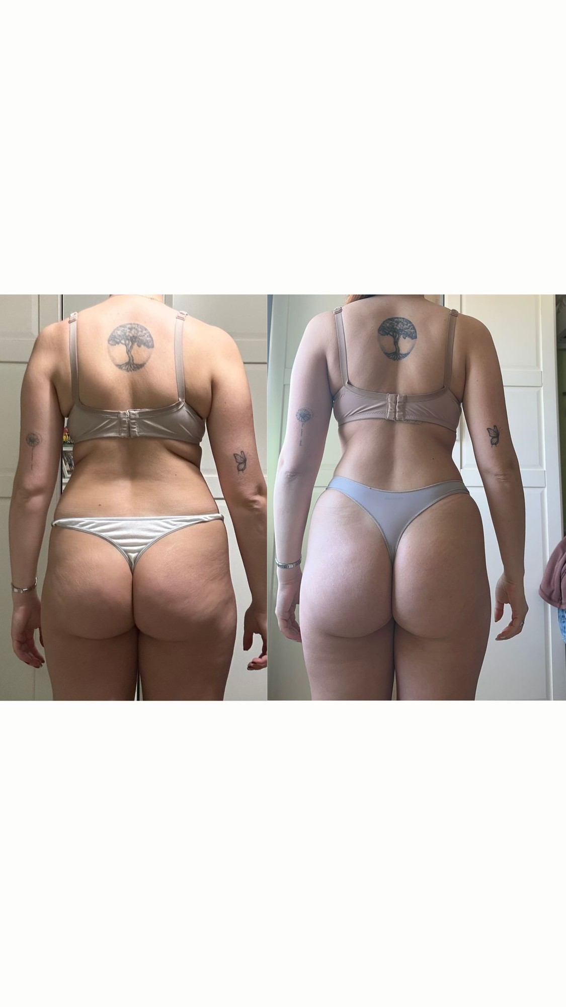 Transformação antes e depois - Cliente 3