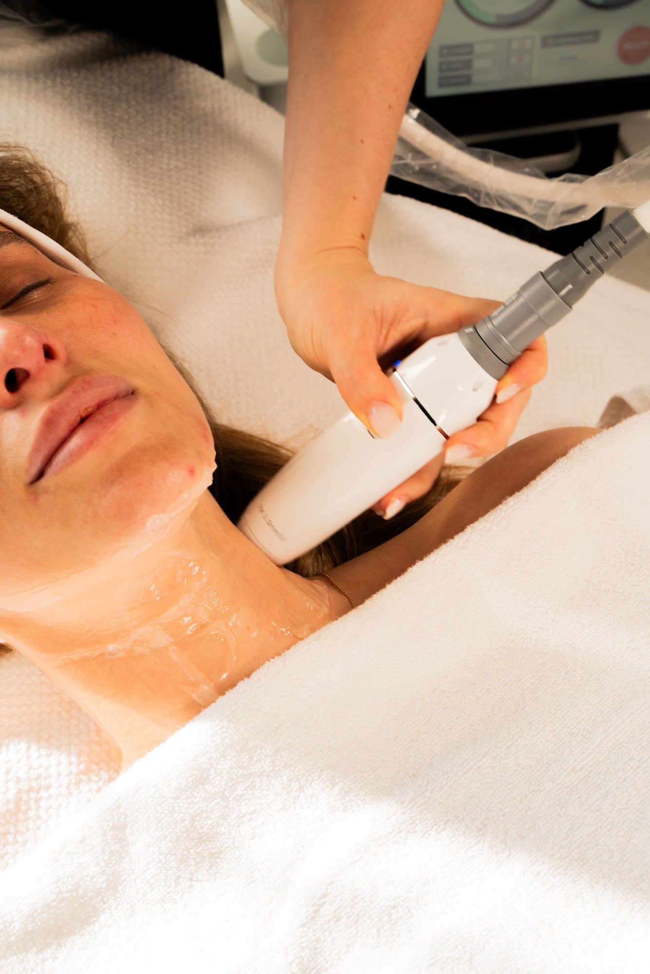 HIFU & Babyglow behandeling