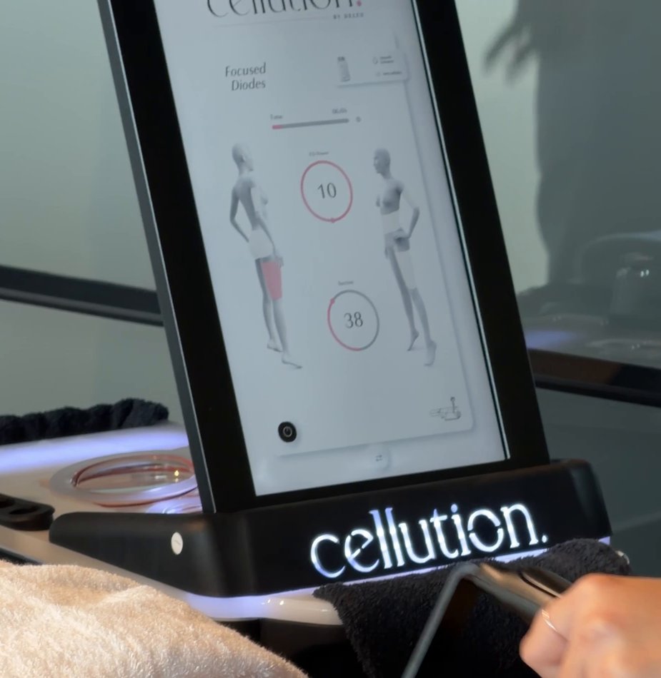 Professionele esthetische technologie