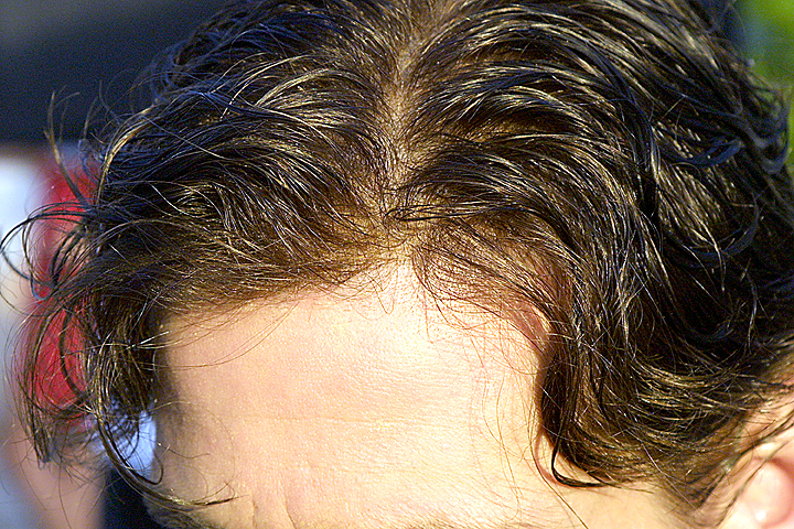 Micropele Masculina