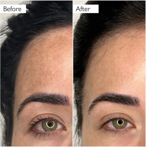 Skinician before and after results showing visible transformation