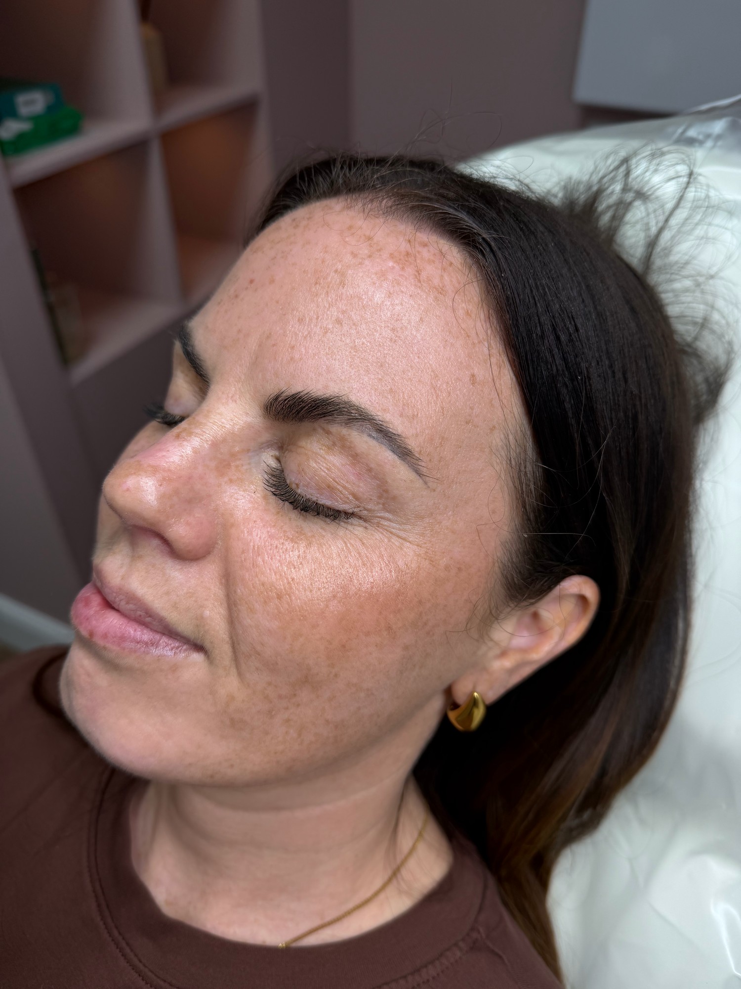 Lip Blush — natural · healed result