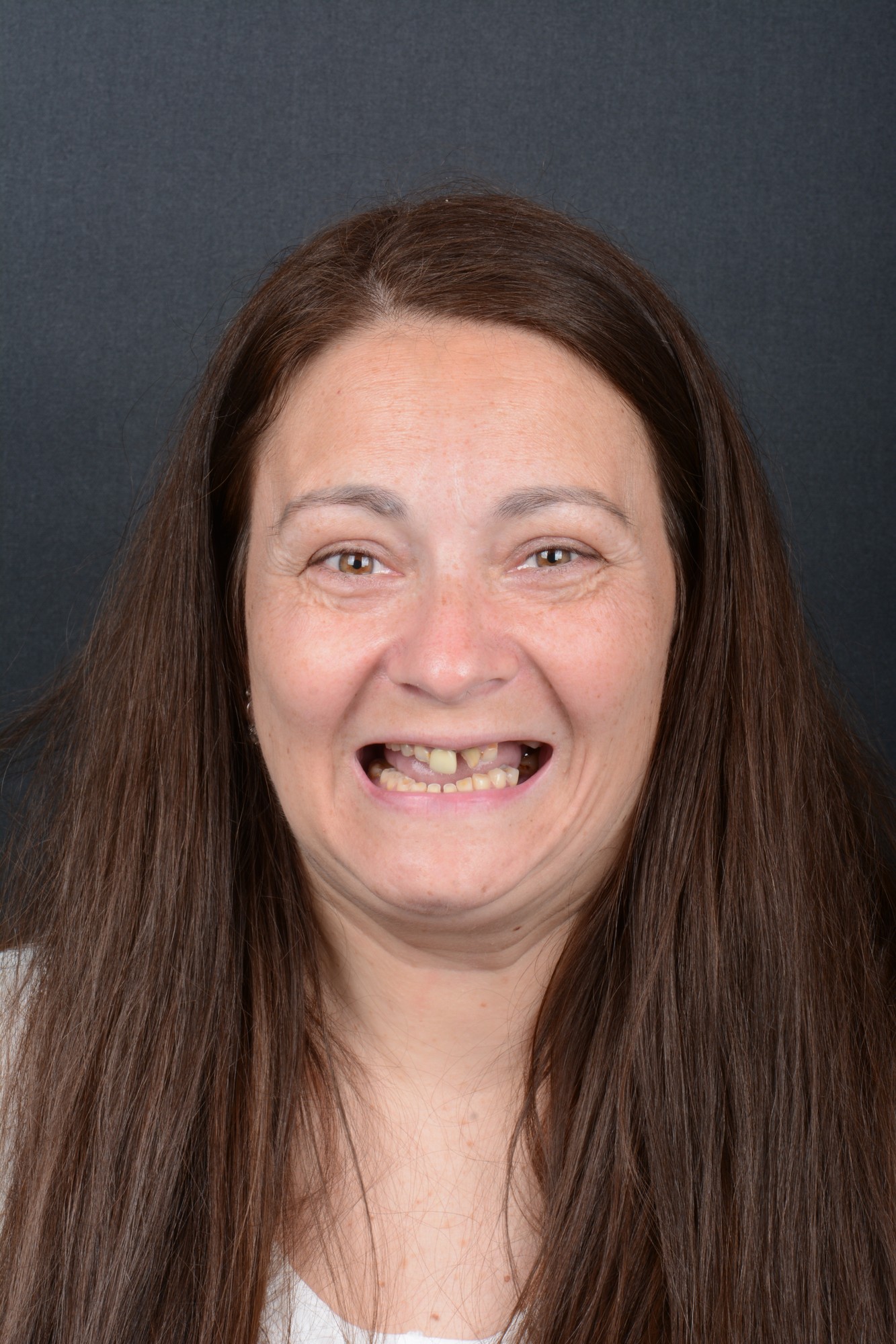 Jana Maláková – před zákrokem (foto 2)