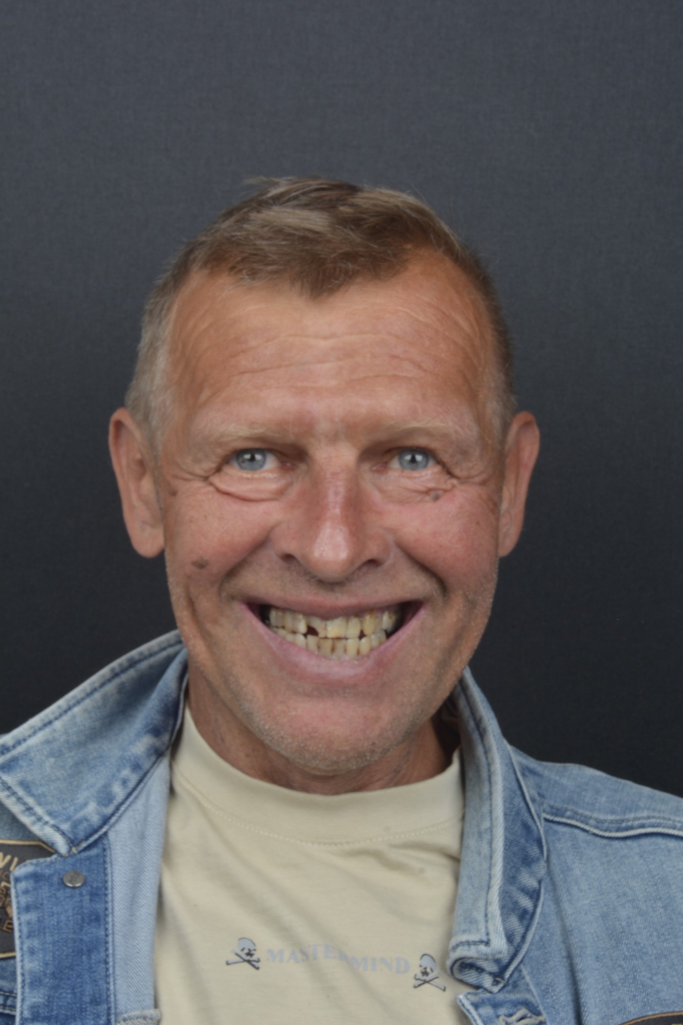 Josef Víns – před zákrokem (foto 1)