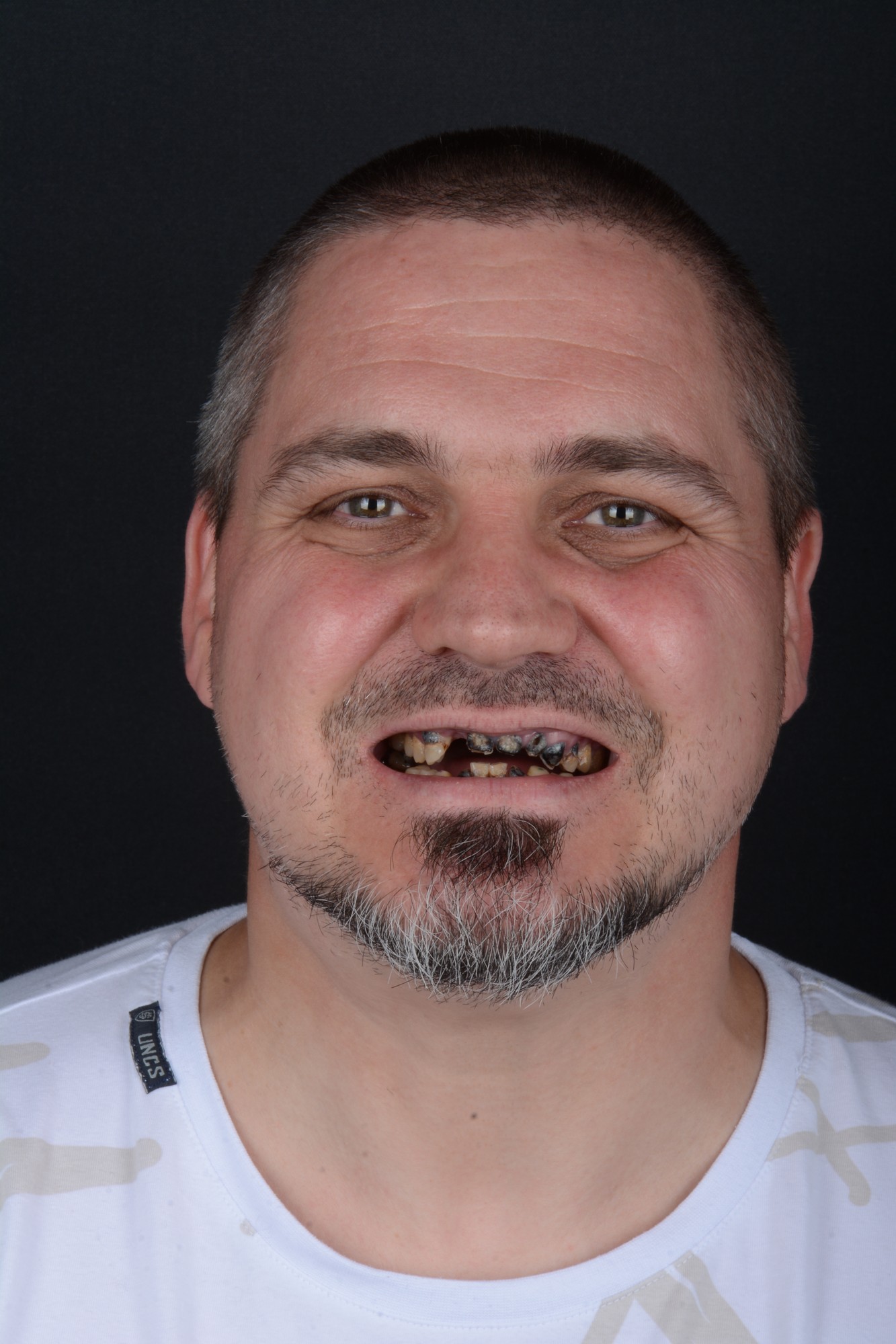 Lukáš Bouda – před zákrokem (foto 2)