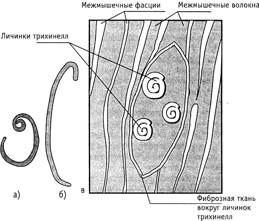 obr9
