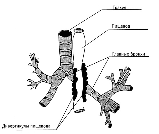 obr13