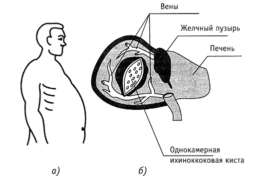 obr15