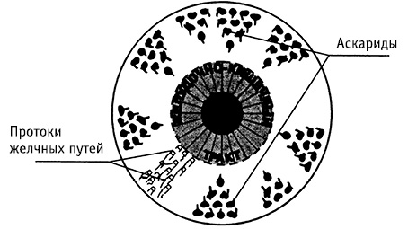 obr2