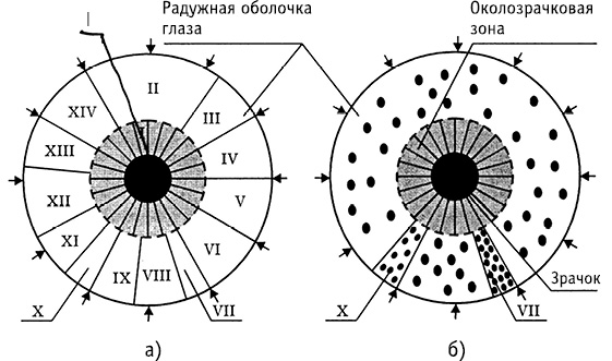 obr1